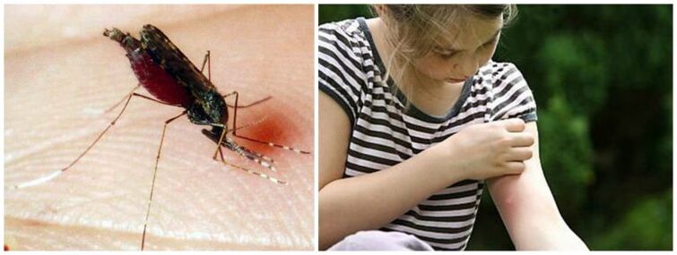 Os bultos dolorosos despois dunha picadura de mosquito poden ser un síntoma dun verme do corazón
