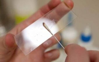 Que probas deben realizarse para parasitos