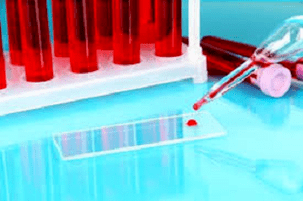Proba de sangue
