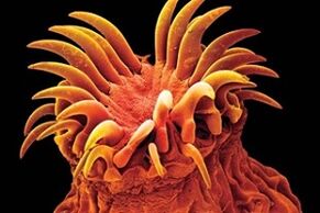 Parasitos trematodos en humanos