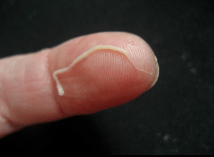 Parasito de verme redondo do corpo humano